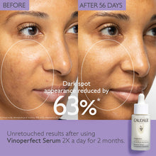 Load image into Gallery viewer, Vinoperfect Radiance Dark Spot Serum Vitamin C Alternative