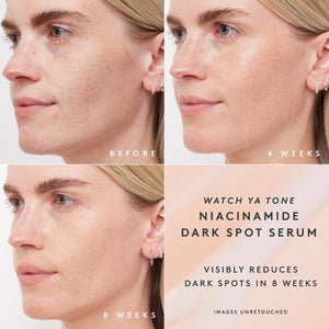 Watch Ya Tone 5% Niacinamide Dark Spot Serum with Vitamin C