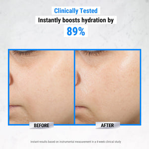 Ultra Pure Hyaluronic Acid 1.5% Serum