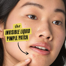 Load image into Gallery viewer, Truly Targeted Acne-Clearing Salicylic Acid Pimple Patch