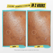 Load image into Gallery viewer, Truly Targeted Acne-Clearing Salicylic Acid Pimple Patch