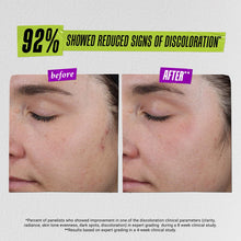 Load image into Gallery viewer, Auto-Tone Skin Discoloration Treatment with SPF 30