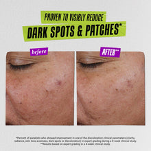 Load image into Gallery viewer, Auto-Tone Skin Discoloration Treatment with SPF 30