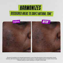 Load image into Gallery viewer, Auto-Tone Skin Discoloration Treatment with SPF 30