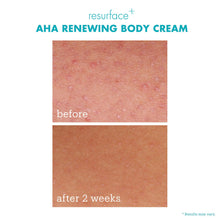 Load image into Gallery viewer, Resurface+ AHA Renewing Body Cream
