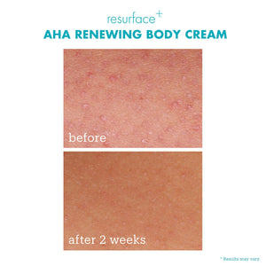 Resurface+ AHA Renewing Body Cream