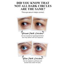 Load image into Gallery viewer, Powerful-Strength Dark Circle Reducing Vitamin C Eye Serum