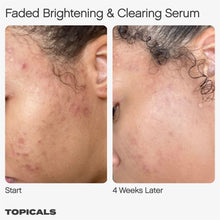Load image into Gallery viewer, Faded Serum for Dark Spots &amp; Discoloration